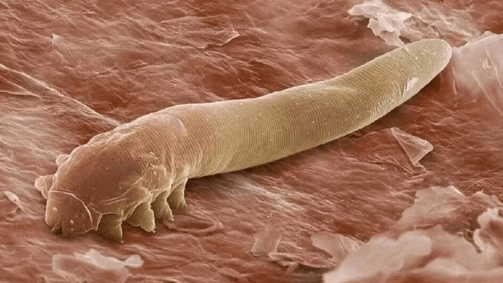Parasitoak giza gorputzean
