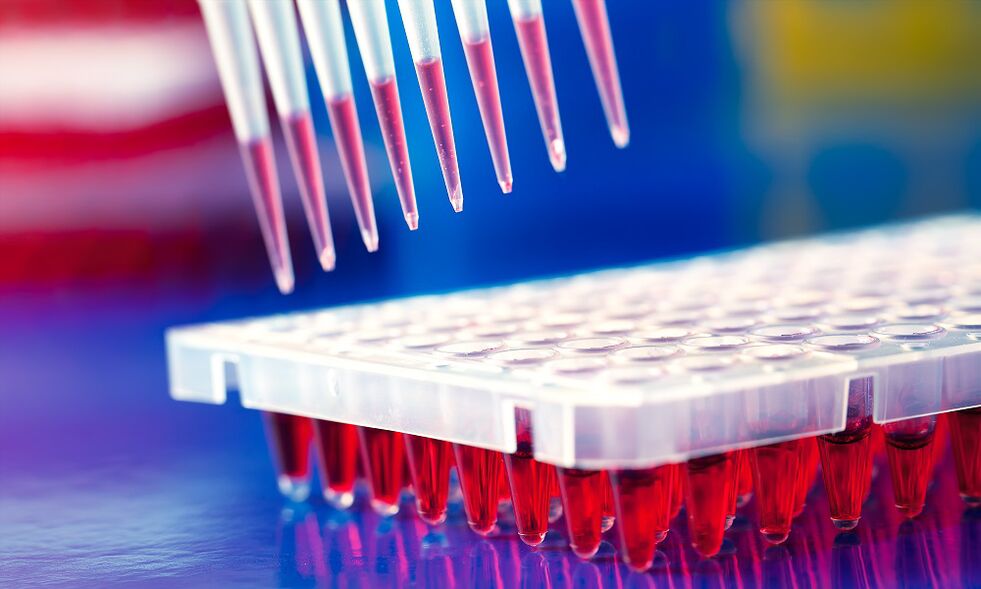 Entzimaren immunoassay odol-proba - infekzio parasitoak diagnostikatzeko metodoa